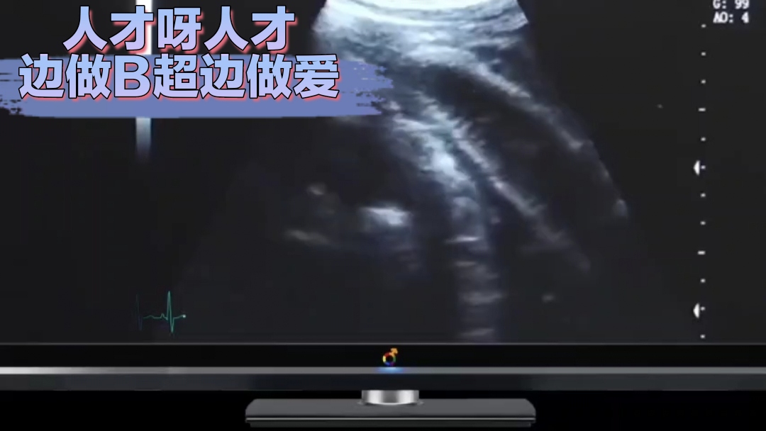 【粉絲福利205】人才呀人才醫生邊做B超邊做愛